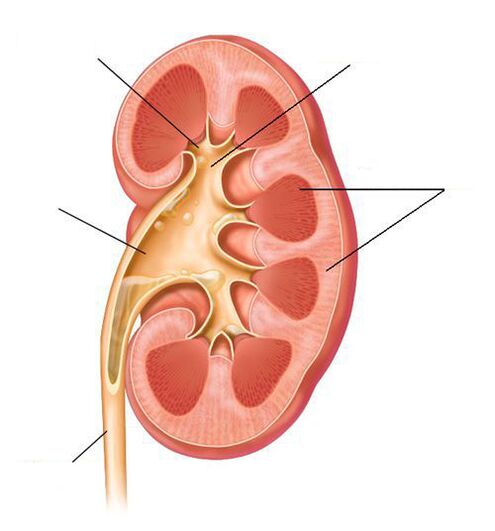 Akute Pyelonephritis als Komplikation einer Zystitis.